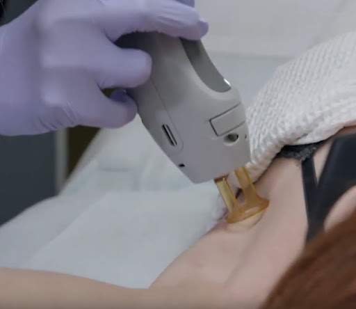 Explore allen iverson tattoo ideas, creative tattoo ideas in Boise, available at Spa 35 Med Spa