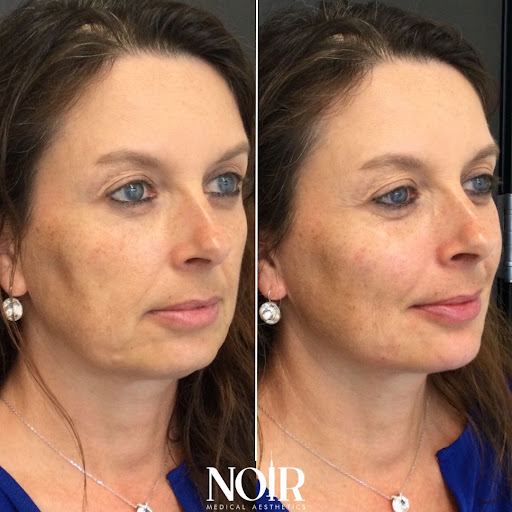 Noir Medical Aesthetics image