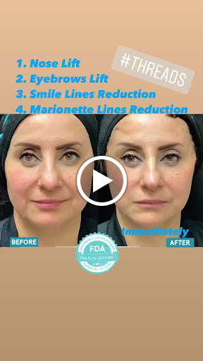 Explore ff7 tattoo ideas, creative tattoo ideas in Lake Oswego, available at Lake Oswego Vein and Aesthetic LOVA