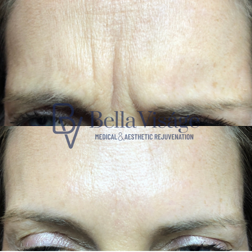 Explore small tattoo ideas for men's, creative tattoo ideas in Lakeland, available at Bella Visge Medical & Aesthetic Rejuvenation