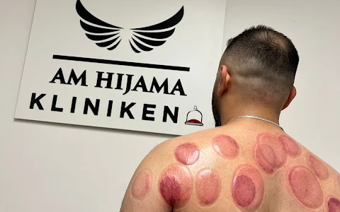 AM Hijama Kliniken - Sport rehab - Koppning - Massage - Göteborg image