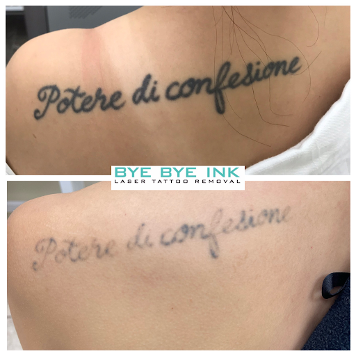 Explore rip tattoo ideas for females, creative tattoo ideas in Middle Village, available at Bye Bye Ink Laser Tattoo Removal