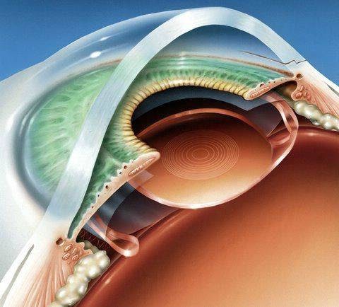 Øjenklinikken Skt. Clemens - Øjenlæge, Øjenoperation, grå stær & øjenlågskirurgi - Nivå
