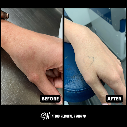 Explore tramp tattoo ideas, creative tattoo ideas in San Antonio, available at South West Tattoo Removal Program