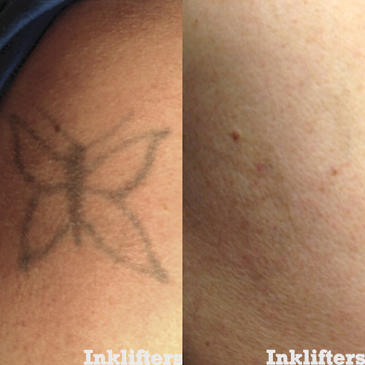 Explore mother earth tattoo ideas, creative tattoo ideas in Pleasant Grove, available at Inklifters Tattoo Removal