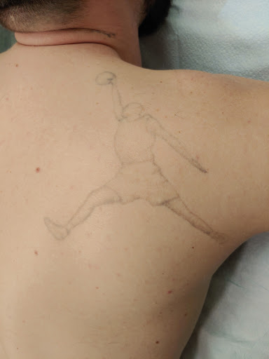 Explore small red tattoos ideas, creative tattoo ideas in Easton, available at Precision Laser LLC