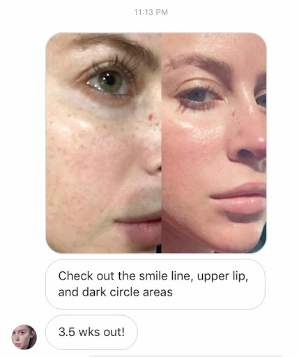 Explore brother sister tattoo ideas, creative tattoo ideas in Middle Village, available at Bye Bye Ink Laser Tattoo Removal
