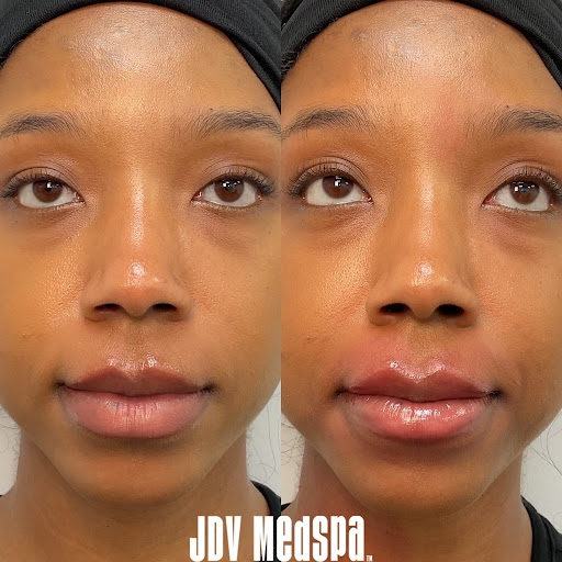 Explore france tattoo ideas, creative tattoo ideas in Canton, available at JDV Med Spa