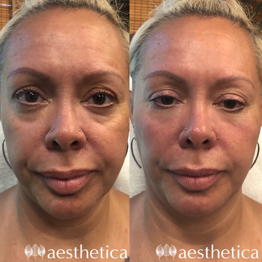 Explore full sleeve tattoo ideas for women, creative tattoo ideas in Pleasant Grove, available at Aesthetica