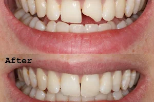 Fresh Dental Smile Clinic & Implant Center York image