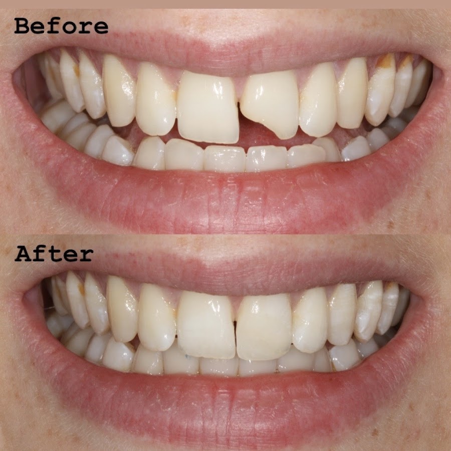 Fresh Dental Smile Clinic & Implant Center York