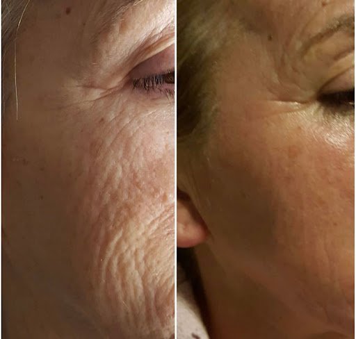 Explore 555 tattoo ideas, creative tattoo ideas in Tucson, available at Allure Medical