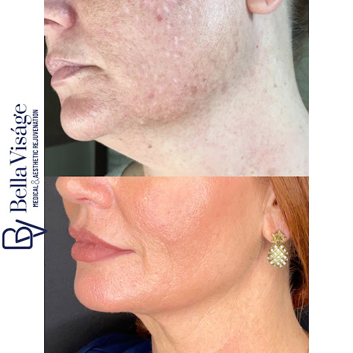 Explore simple alaska tattoo ideas, creative tattoo ideas in Lakeland, available at Bella Visge Medical & Aesthetic Rejuvenation