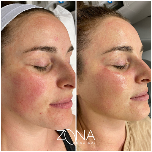 Skin Care Clinic «ZONA MED SPA», reviews and photos, 9767 N 91st St #102, Scottsdale, AZ 85258, USA