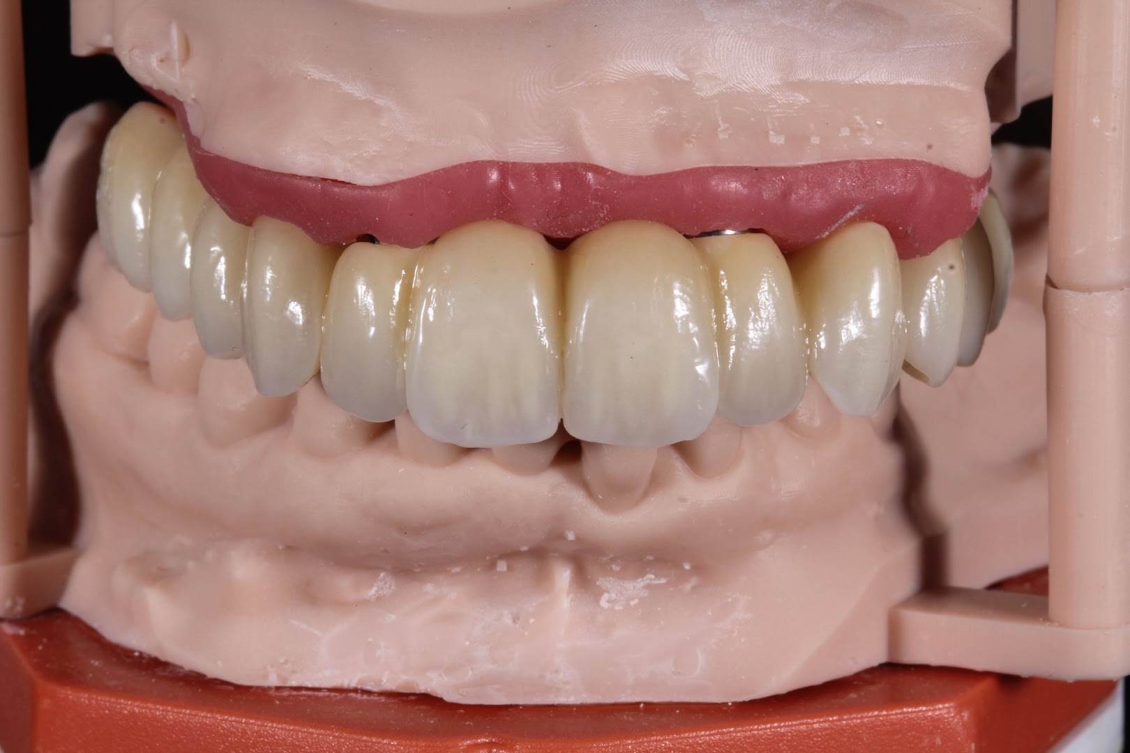Montesinos Dental S.L - Protésicos Dentales