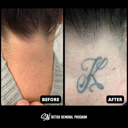 Explore mom tattoo ideas for guys, creative tattoo ideas in San Antonio, available at South West Tattoo Removal Program