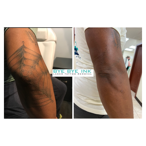 Explore easy drawings tattoo ideas, creative tattoo ideas in Middle Village, available at Bye Bye Ink Laser Tattoo Removal