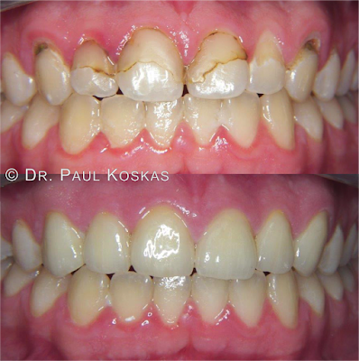 Dentiste Argenteuil : Dr. Paul Koskas à Argenteuil