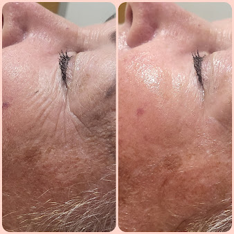 Rejuvenate Skincare Aesthetics - Rejuvenate Skincare Aesthetics