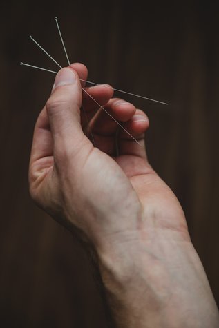 EJ Fry Acupuncture