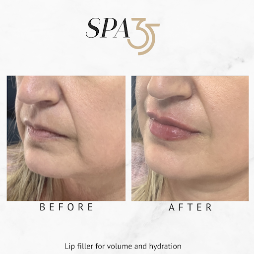 Find fox tattoo ideas for your next unique tattoo in Boise at Spa 35 Med Spa