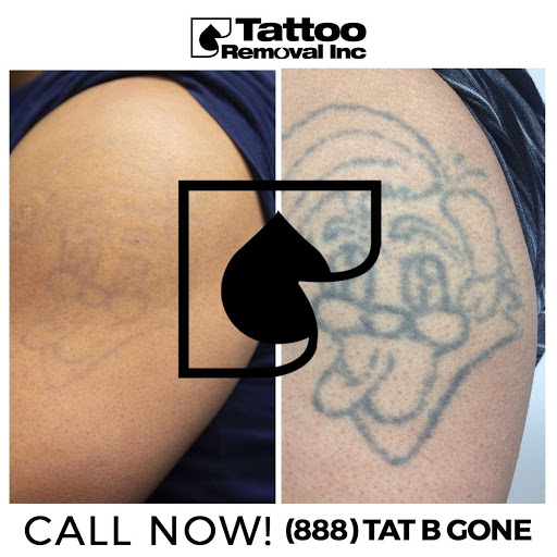 Explore pnw tattoo ideas, creative tattoo ideas in South Gate, available at Tattoo Removal Inc