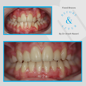 مالمين لطب الأسنان - ليفربول - Malmin Dental - Liverpool