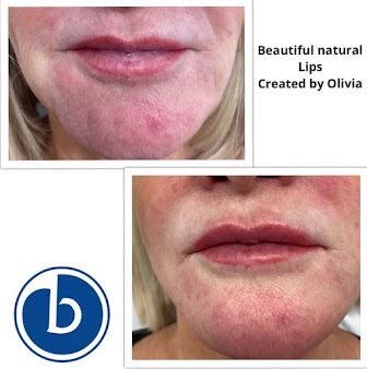عيادة باي للوجه - Bay Facial Clinic