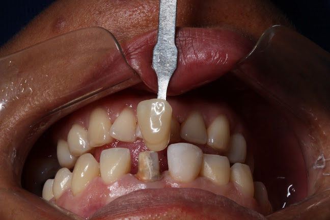 Comentarios y opiniones de CEDENTY Odontologia Especializada