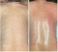 Sweet Touch Waxing and Facials - Photo 8 - Car repair in West Palm Beach, FL, West Palm Beach