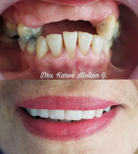 Consultorio Odontologico Dra. Karen Molina - Portoviejo
