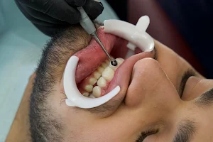 Porcelain Veneers | Dominican Republic image