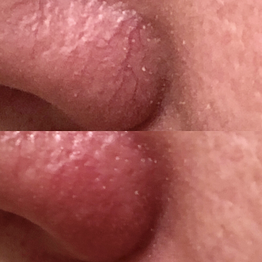 Explore blessing tattoo ideas, creative tattoo ideas in Summit, available at Ethos Aesthetics and Wellness, Laser Hair Removal and Med Spa