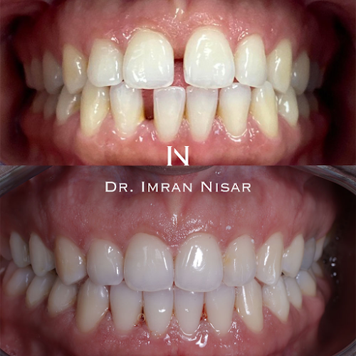 Comments and reviews of Dr. Imran Nisar
