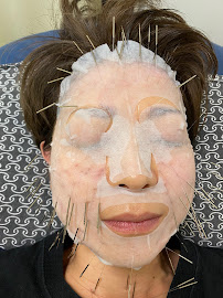 Ginzasozen Acupuncture