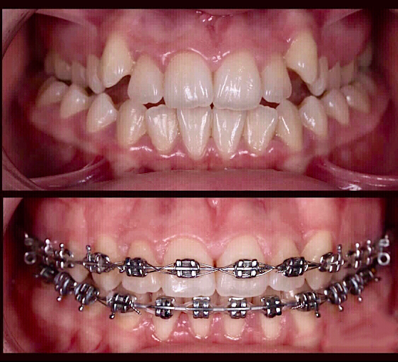 Maruthi Dental & Face Surgical Centre - Maruthi Dental & Face Surgical Centre