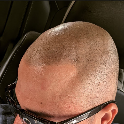 Explore weeping willow tattoo ideas, creative tattoo ideas in Roseville, available at NuHair Ink. Scalp MicroPigmentation & Aesthetic Clinic of Sacramento