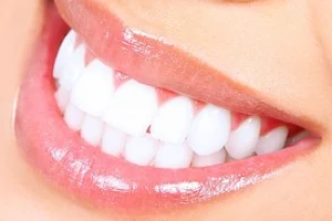 Platinum Dental image