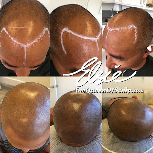 SMP Hair Clinic The Queen Of Scalp image