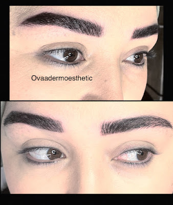 Ovaadermoesthetic à Choisy-le-Roi
