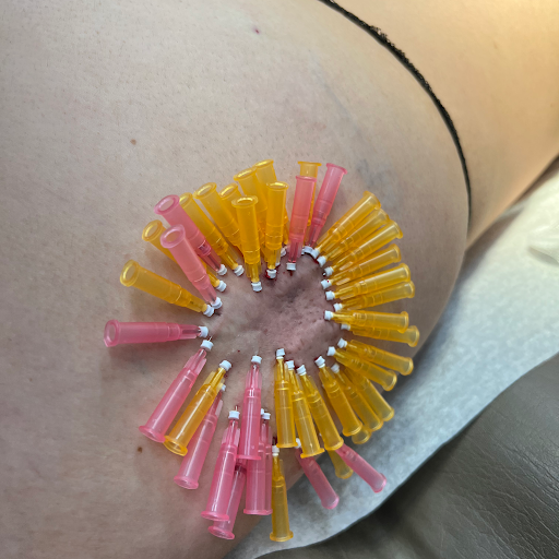 Explore neon genesis evangelion tattoo ideas, creative tattoo ideas in Lake Oswego, available at Lake Oswego Vein and Aesthetic LOVA