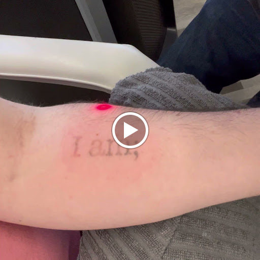 Explore back forearm tattoo ideas, creative tattoo ideas in New York, available at Ag2g Laser Tattoo Removal & MedSpa