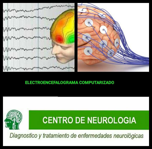 Centro de Neurología Escalón