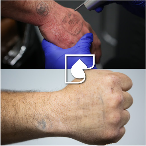 Explore purple rose tattoo ideas, creative tattoo ideas in South Gate, available at Tattoo Removal Inc