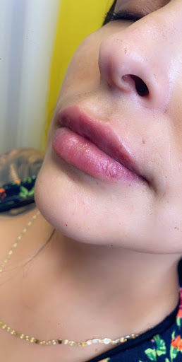 Lifted Beauty Medical Practice image