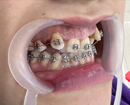 Af1qipor5vqxbjy4su07ljhgjdhvvegpnlm4zoa6lfso