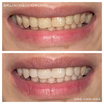 Klinik Gigi Orchid - Klinik Gigi Orchid