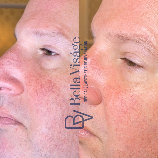 Explore small compass tattoo ideas, creative tattoo ideas in Lakeland, available at Bella Visge Medical & Aesthetic Rejuvenation