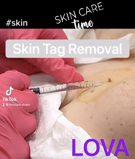 Explore mens simple tattoo ideas, creative tattoo ideas in Lake Oswego, available at Lake Oswego Vein and Aesthetic LOVA