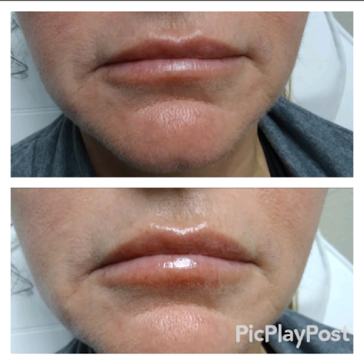 Explore good tattoo ideas for family, creative tattoo ideas in Edmond, available at Zen Aesthetics & Wellness Medical Spa